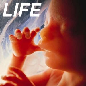 A baby in the womb, sucking its thumb, with the caption "LIFE"